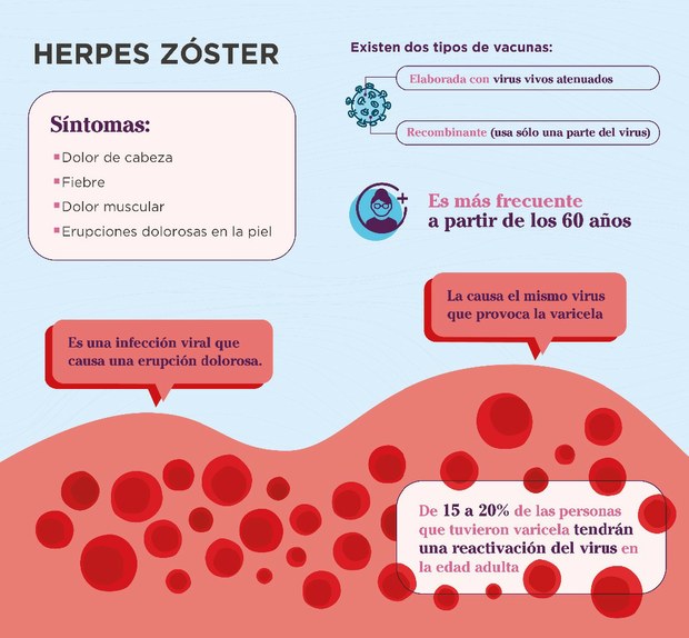 El herpes zóster tiene una vacuna — letraese